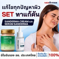 รับฟรี! สบู่ Sanderma 1 ก้อน เมื่อซื้อ COMBO ครีมและเซรั่ม SANDERMA สูตรเฉพาะสำหรับโรคผิวหนังทุกชนิด
