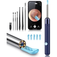 Ear Wax Removal Tool Camera - Ear Wax Removal Kit - Ear Cleaner with Camera - 1080P HD Ear Camera wi