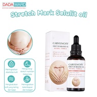 Dadaward Cellulite Scars for Pregnant Women Stretch Mark Removal Cream Bio Oil Scab Scars/Stretch Ma