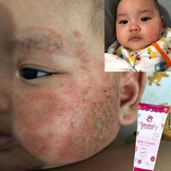 krim ajaib eczema | multifunction