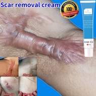 Scar removal cream stretch mark keloid ubat parut hilangkan krim ubat parut kaki menghilangkan bekas