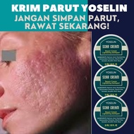 ORIGINAL Yoselin®krim hilangkan parut lekuk Hilangkan parut kaki Menghilangkan bekas luka lama Parut