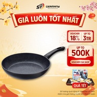 Fissler Stardust Forte Classic Premium Quality GernanySnT Marble Non-Stick Pan