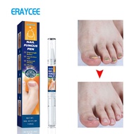 Cleaning Nail Pen Pen Pen Onychomycosis Pack 1 Thick Brightening Onychomycosis Care Nail Care Liquid