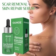 Uohoe scar removal cream, genuine scar removal repair cream