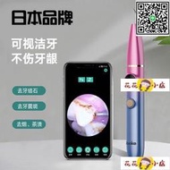 滿299發貨洗 洗 日本yabake可視結石去除潔儀洗齒污垢除石超聲波洗