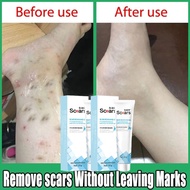 Scar Removal Gel Cream 20g Keloid Scar Removal Scar Gel Repair Old Black Scars-Acne Scar-Stretch Mar