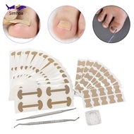 [Simhoa] Ingrown Toenail Correction Kit, Breathable ,Ingrown Toenail Repair ,Pedicure Tools, Toenail