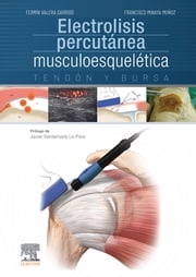 Electrolisis percutánea musculoesquelética Fermín Valera Garrido, PT MSc PhD