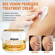 2024 New Bee Venom Psoriasis Cream,30g Bee Venom Psoriasis Cream,New Zealand Bee Venom Cream,Bee Venom Cream,Psoriasis Cream