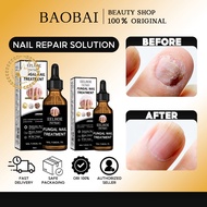 Eelhoe Nail Repair Solution 50ml Antibacerial Nail Fungus Treatment Anti Onychomycosis Nail Repair E