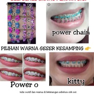 Removable Braces // Removable Fashion Braces // top/bottom only