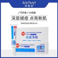 Anti-Acne Cream Antibacterial AcnePimple Face Cream 30g 祛痘膏痤疮膏淡印膏 淡化痘印 平衡水脂