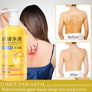eczema body wash Pengobatan Eksim psoriasis eksim kering Kurap gatal kulit jamur kulit eksim lotion