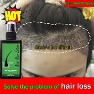 Neo Hair Lotion Spray Hair Growth Spray Hair Loss Treatment Anti Hair Loss Hair Regrowth Hair Care H