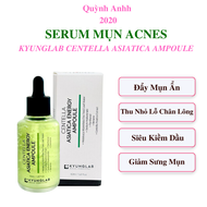 Serum Mụn Ngừa Mụn KyungLab Acnes Centella Asiatica Ampoule Quỳnh Anhh 2020 50ml