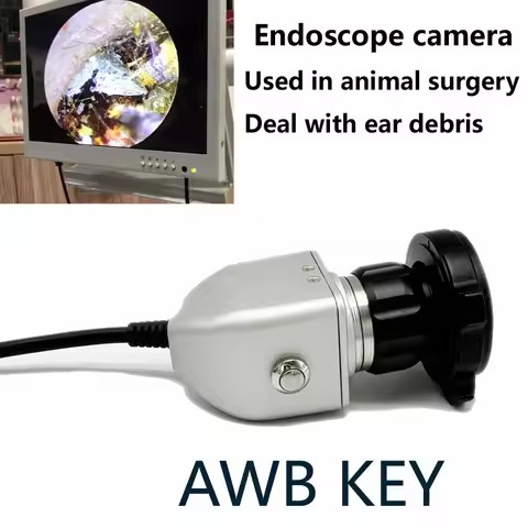 AWB Key Medical CCD Endoscope Camera ENT Inspection with F22mm Coupler Connect Monitor Ear Endoscopi