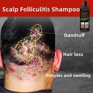 Syampoo kelemumur dan gatal Antifungal shampoo  kepala Psoriasis scalp Itchy scalp  Scalp treatment 