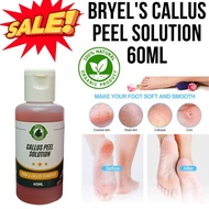 Kalyo Peel/Callus Peel Remover And Callus Pile/Pantanggal Kalyo/Callus remover