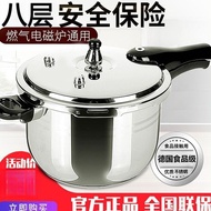 Explosion-Proof 304 Stainless Steel High Pressure Cooker Household Gas Thickened Induction Cooker Un