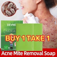 Wormwood Mite Acne Soap Psoriasis Anti Fungal Itching Sulfur Soap Bath Whitening Antibacterial Soap
