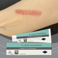 Scar Repair Fade-Out Scald Scar Skin Wound Cream Moisturizing Rejuvenating Hydrating Repair Cream Sk