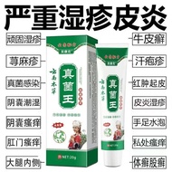 Itchy and anti-Itchy cream for cowhide, tinea cervix, eczema皮肤瘙痒止痒膏牛皮银、屑癣、湿疹、皮炎、水泡全身皮肤外用膏8.15