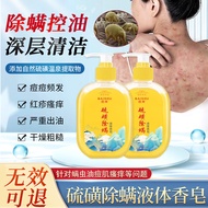 【好物直降】硫磺除螨沐浴露螨虫后背痘痘祛控油去多效沐浴皂液露滋润硫磺液体香皂男女 硫磺沐浴露*1瓶