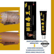 Salep Hitam Cap Kobra Asli Gatal Kulit Paling Ampuh Eksim Skabies Scabies Manusia Kadas Kudis Kurap