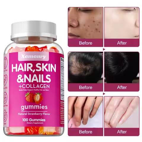High Potency Biotin Gummies - for Healthy Hair, Skin & Nails, Hair Vitamins for Men & Women | Gluten