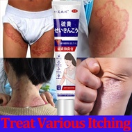 Original Japan eczema cream 20g Psoriasis Rashes Ezcema Fungal  Antifungal Anti skin itch Herbal cre