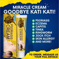Cream for itchy fungus, psoriasis, ringworm, hives, keratosis, dermatitis, ringworm