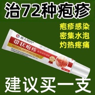 Gel herpes zoster asli, neuralgia pasca-sisa, virus herpes, luka hempedu ular, kulit sakit cakera ul