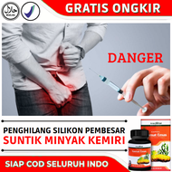Obat Penghilang Suntik Silikon Minyak Kemiri Cair Menghilangkan Minyak Orang Aring Di Alat Vital Pem
