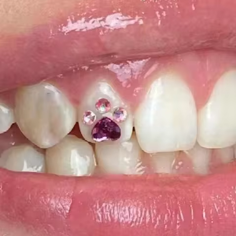 4pcs/box Dental Tooth Gems Cat Paw Heart Shape Color Teeth Jewelry Crystal Diamond Ornament Denture 