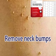 duofilm wart ellgy corn and warts 肉粒去除 wart removal patch warts removal cream curesys acne patch gen