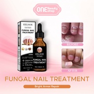Eelhoe Nail Repair Solution Antibacerial Nail Fungus Treatment Anti Onychomycosis Paronychia Nail Re