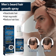 【HOT】[Anti-Hair Loss/Hair Growth]Beard Hair Growth Spray/Ginger Hair Growth Spray 30ml Antibacterial