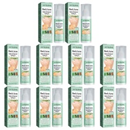Jaysuing Back Acne Repair Spray สิวที่หลัง แอคเน่ สเปรย์ฉีด แผ่นหลังและลำตัว หลังสิวซ่อมสเปรย์ซ่อมแซ
