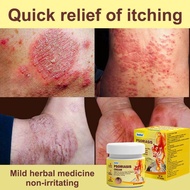 【 3-second itch relief 】 Anti fungal itch relief cream, quick relief itch relief cream, antibacteria