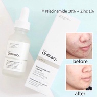 Tinh chất giảm thâm mụn sáng da The Ordinary Niacinamide 10% + Zinc 1% (bản Hàn)