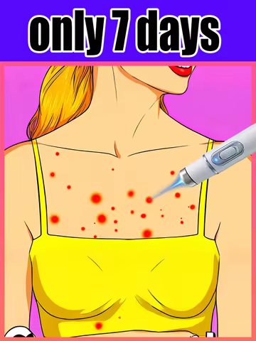 The third generation portable blue light pen: Effective for Body Wart Removal