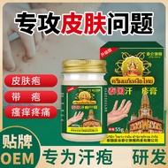 Sweat Discomfort Itching Peeling Rash Cream Anti-Itch Cream Small Blister Hand Special Blister Rash 