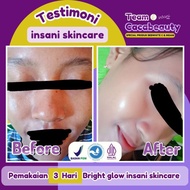 Insani skincare 100% Ori RR