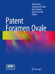 Patent Foramen Ovale Zahid Amin