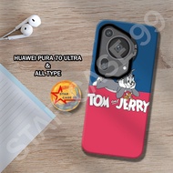 S15-Case hybrid IMD HUWAEI PURA 70 ULTRA - cartoon motif - casing huawei pura 70 ultra-casing-cassin