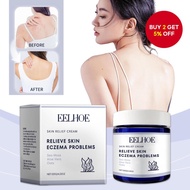 【HOT】120g Anti-Itch Skin Cream: Safe and Natural Relief for Itching, Eczema, Peeling, Redness, and R