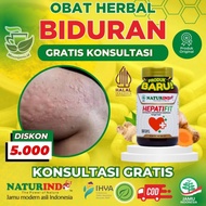 Obat Biduran Alergi Dingin Alergi Panas Biduran Kronis Alergi Biduran