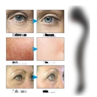 Beauty device ice roller, beauty and skincare roller, women's massage roller, household ice roller