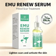 Dermalab Emu Renew Serum 30ml Scar Removal Cream For Acne Scars, Stretch Marks & Surgical Marks Safe